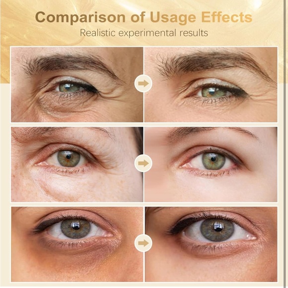 Under Eye Patches (60 Pcs) - 24K Gold Eye Masks for Dark Circles and Puf… - Picture 5 of 9